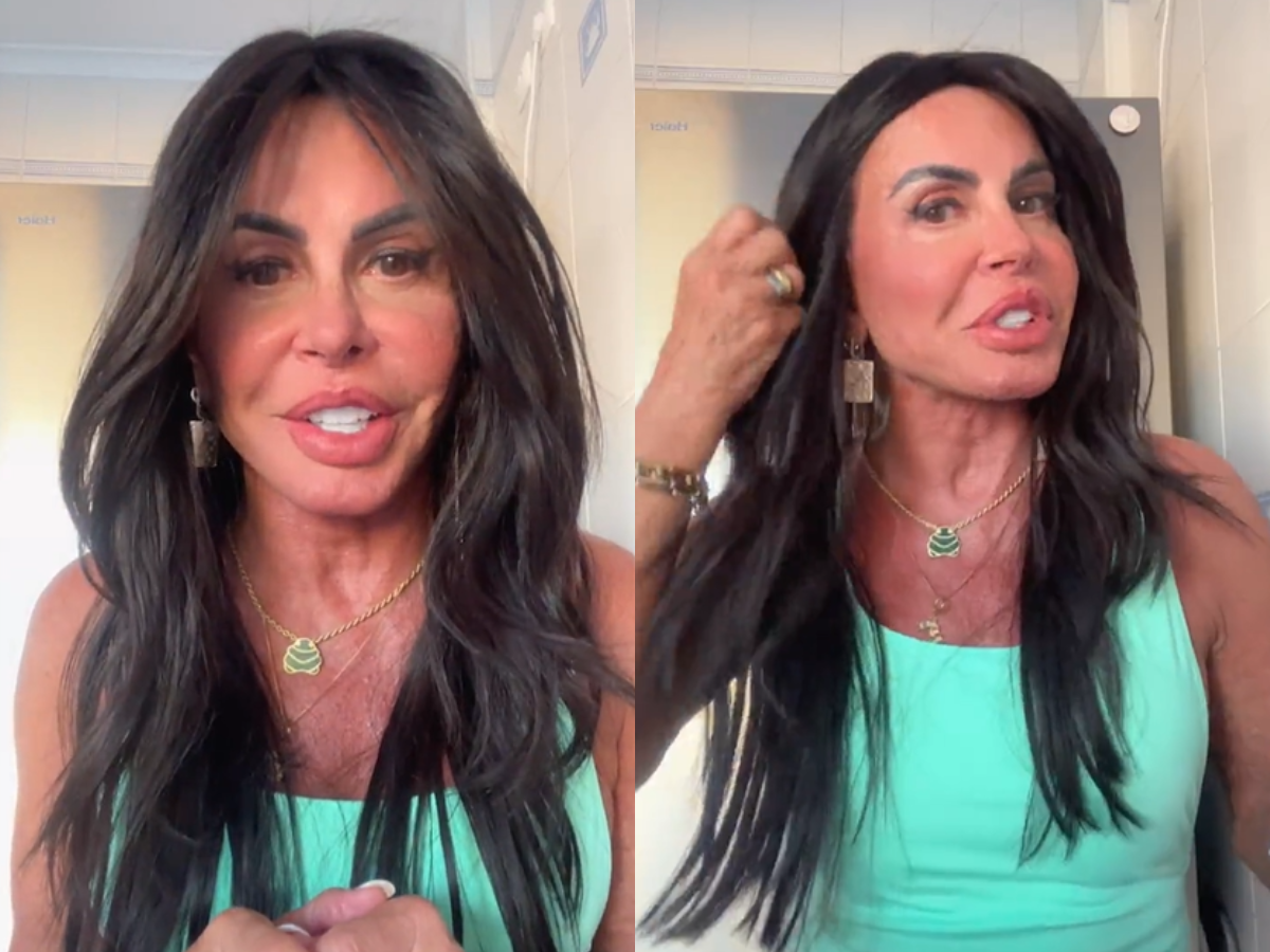 foto-boca-bochecha-e-mandibula-gretchen-exibe-resultado-de-nova-harmonizacao-facial.png